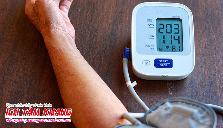 Cao huyết áp là một yếu tố nguy cơ làm hình thành cục máu đông gây đột quỵ
